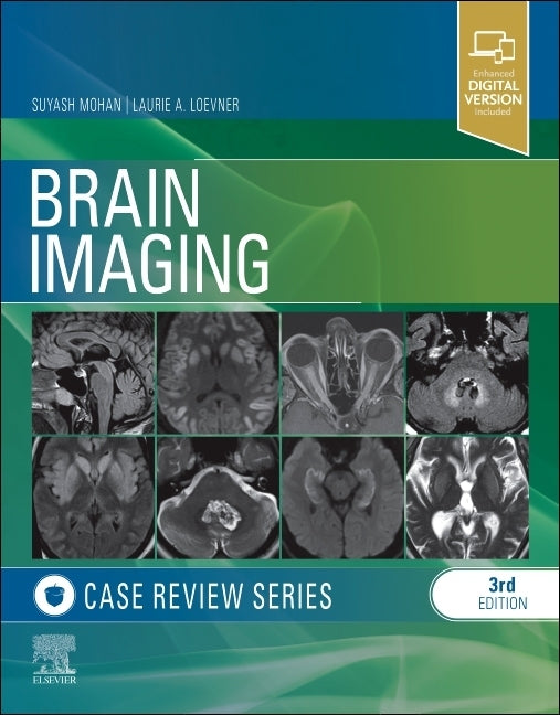 Brain Imaging Case Review - Paperback | Diverse Reads