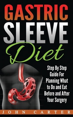 Gastric Sleeve Diet: Step By Step Guide For Planning What to Do and Eat Before and After Your Surgery - Hardcover | Diverse Reads