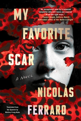 My Favorite Scar - Hardcover | Diverse Reads