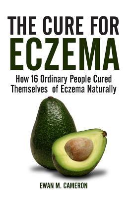 The Cure for Eczema - Hardcover | Diverse Reads